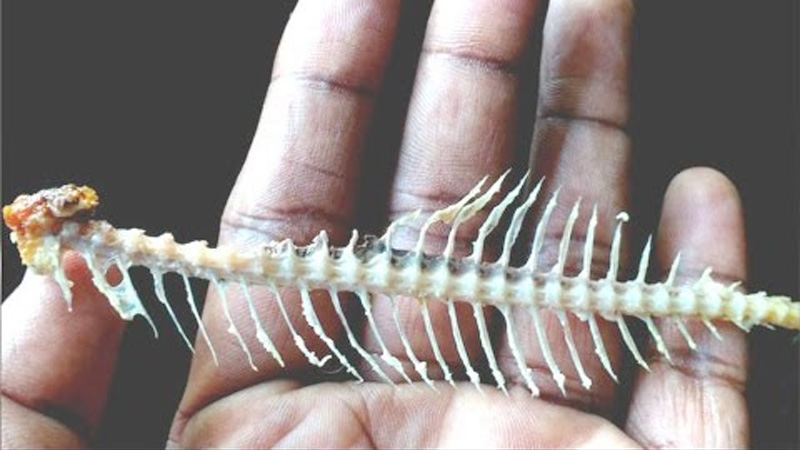 What To Do If You Swallow A Fishbone